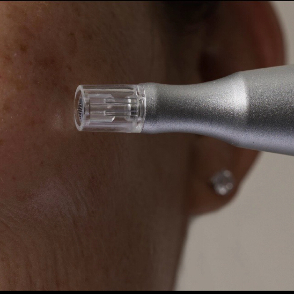 Regenerate Nano Infusion at Deanna Eldridge in Great Bend, KS