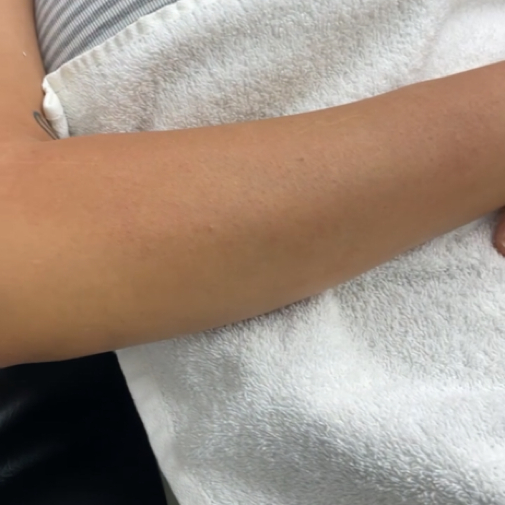Half Arms at iSugar Waxing Studio in Redondo Beach, CA