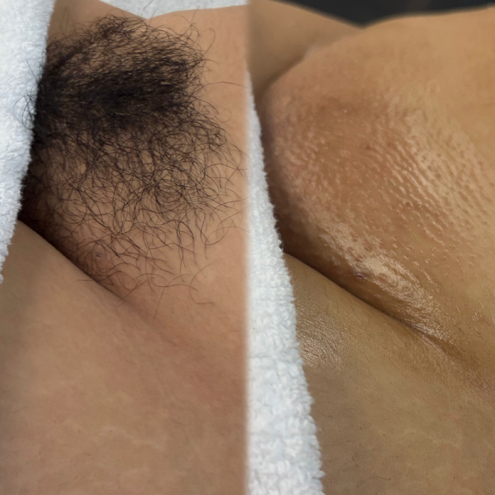 THE BRAZILIAN DUO at Pura Belleza Aesthetics in Avondale, AZ
