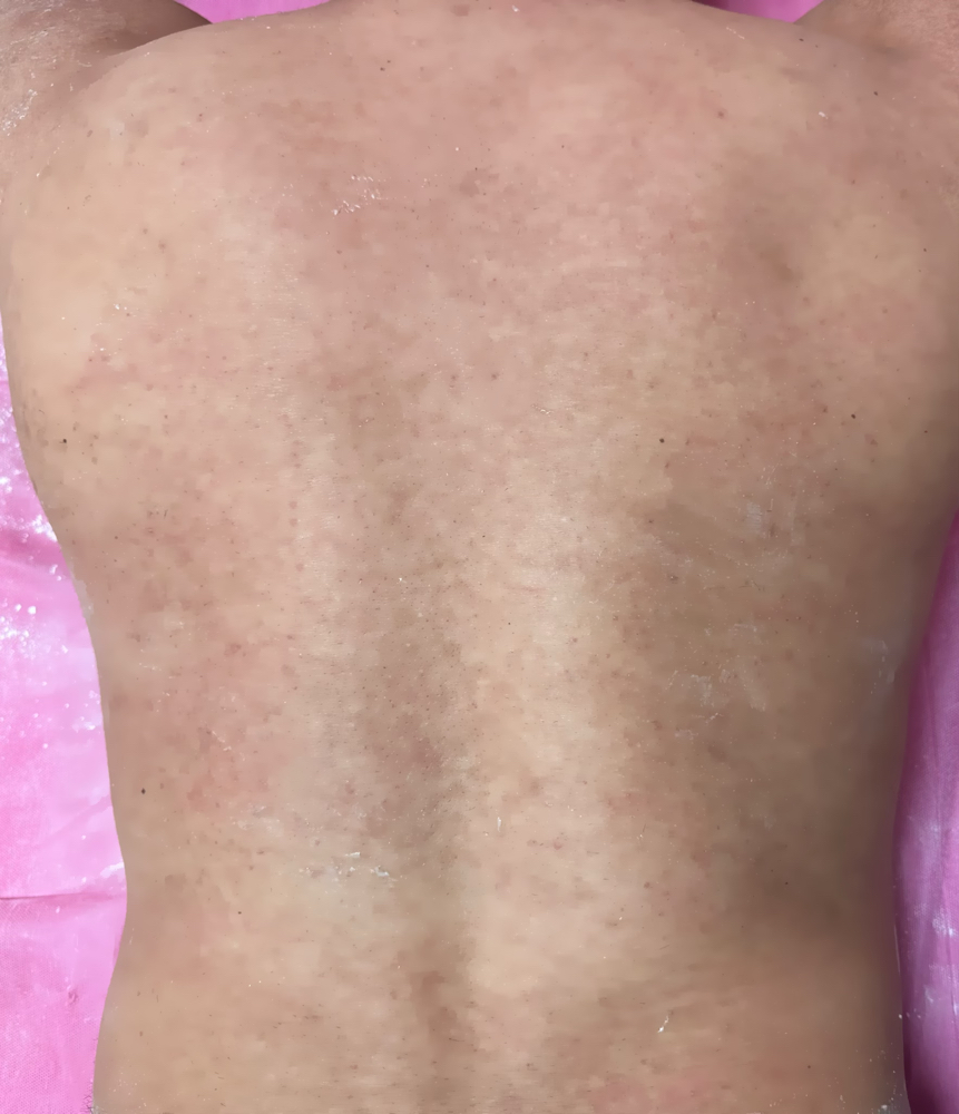 Back Sugaring Wax