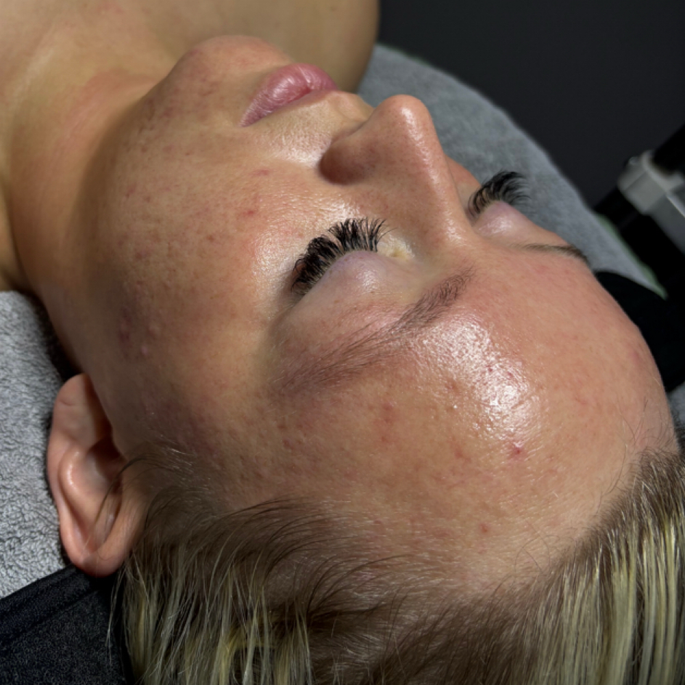 Golden Clarity Facial at Studio P in Lexington, KY
