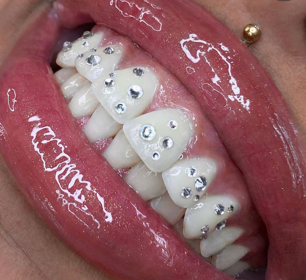 Tooth Gem Freestyle  💎