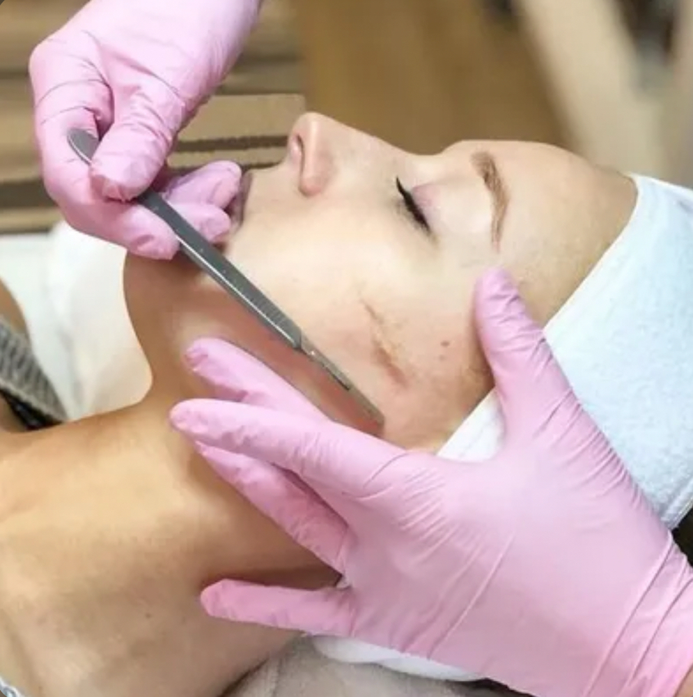 Dermaplane Facial