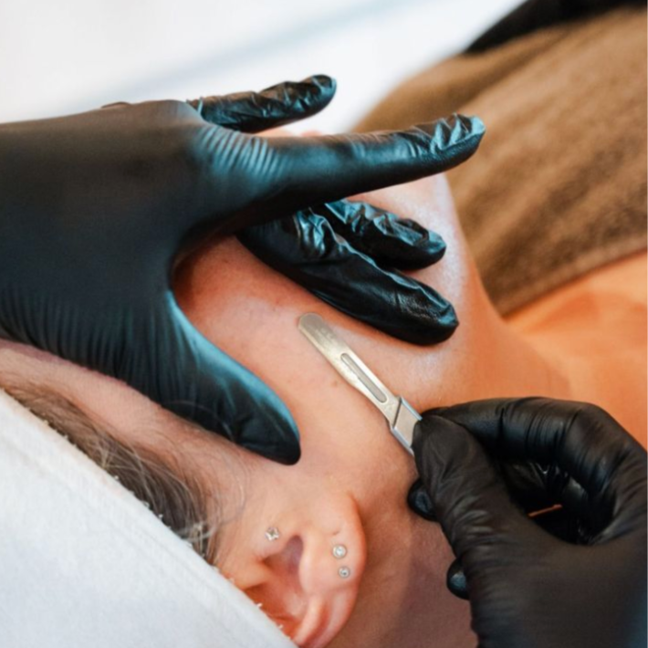 Prickly Pear Dermaplane Facial at Saige Esthetics in Eagle, ID