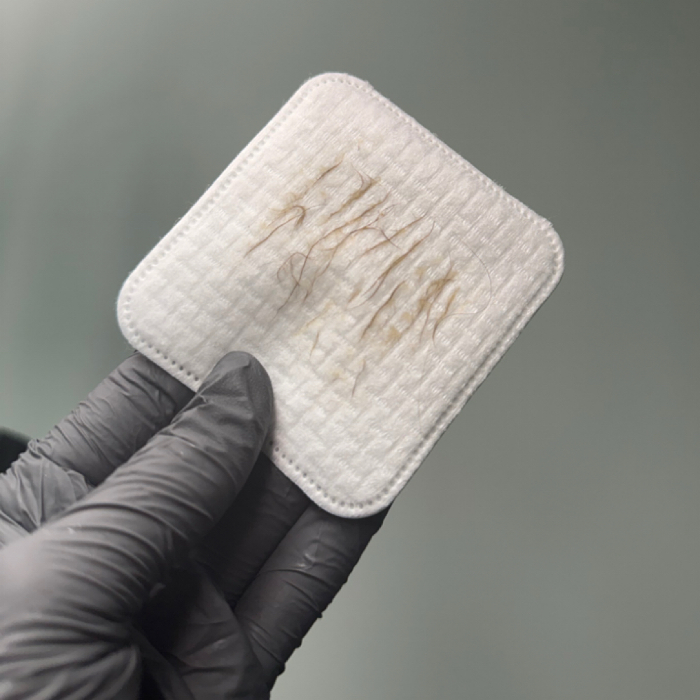 Dermaplane Add-On at Skylar Ashley Aesthetics in Leitchfield, KY