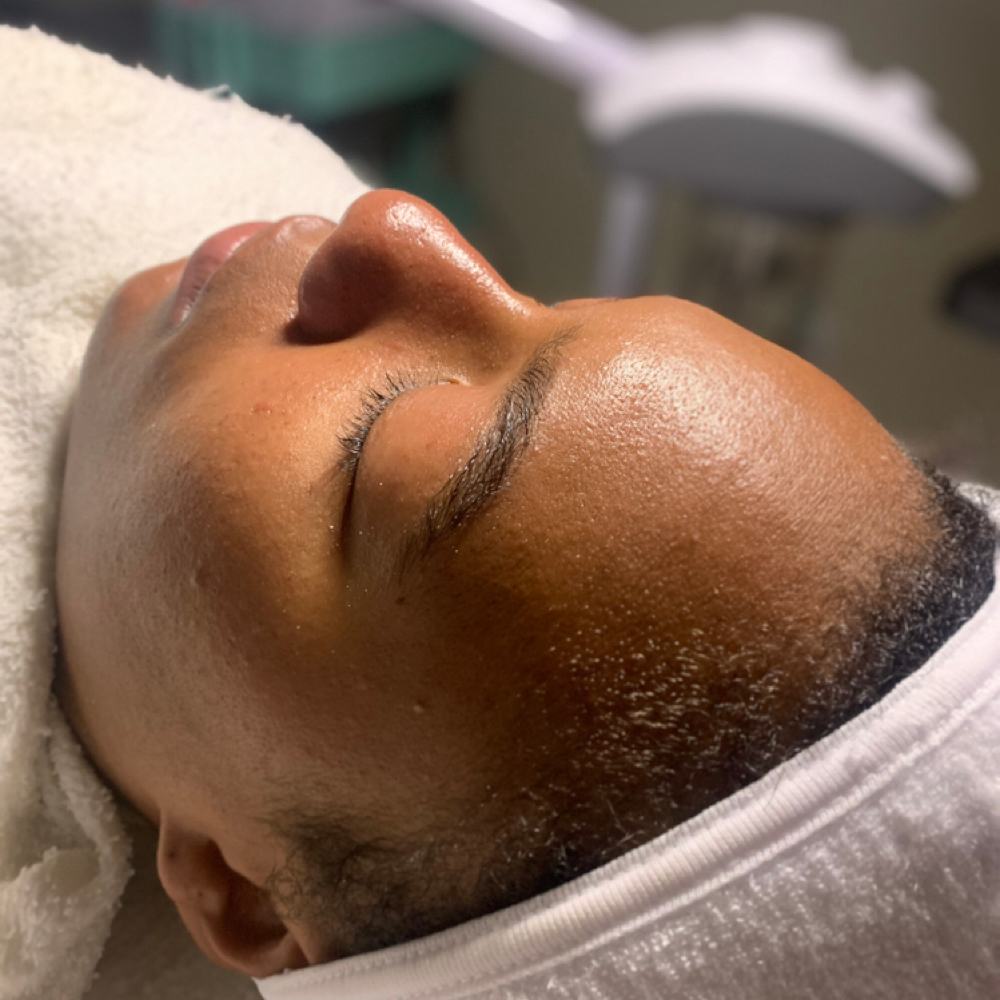 Microdermabrasion at Poshii GOAT Esthetics in Carmel, IN