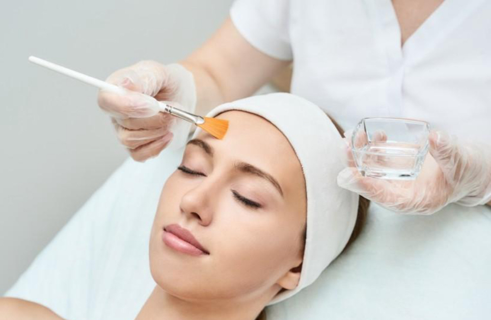 Chemical Peel