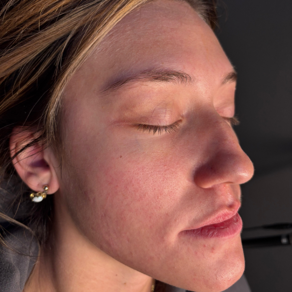 Skin Evaluation at EVLO Salon Suites in Nampa, ID