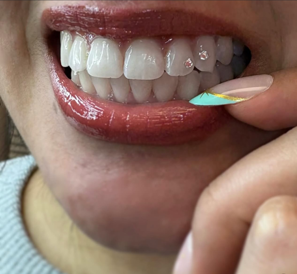 2 Round Gem Application