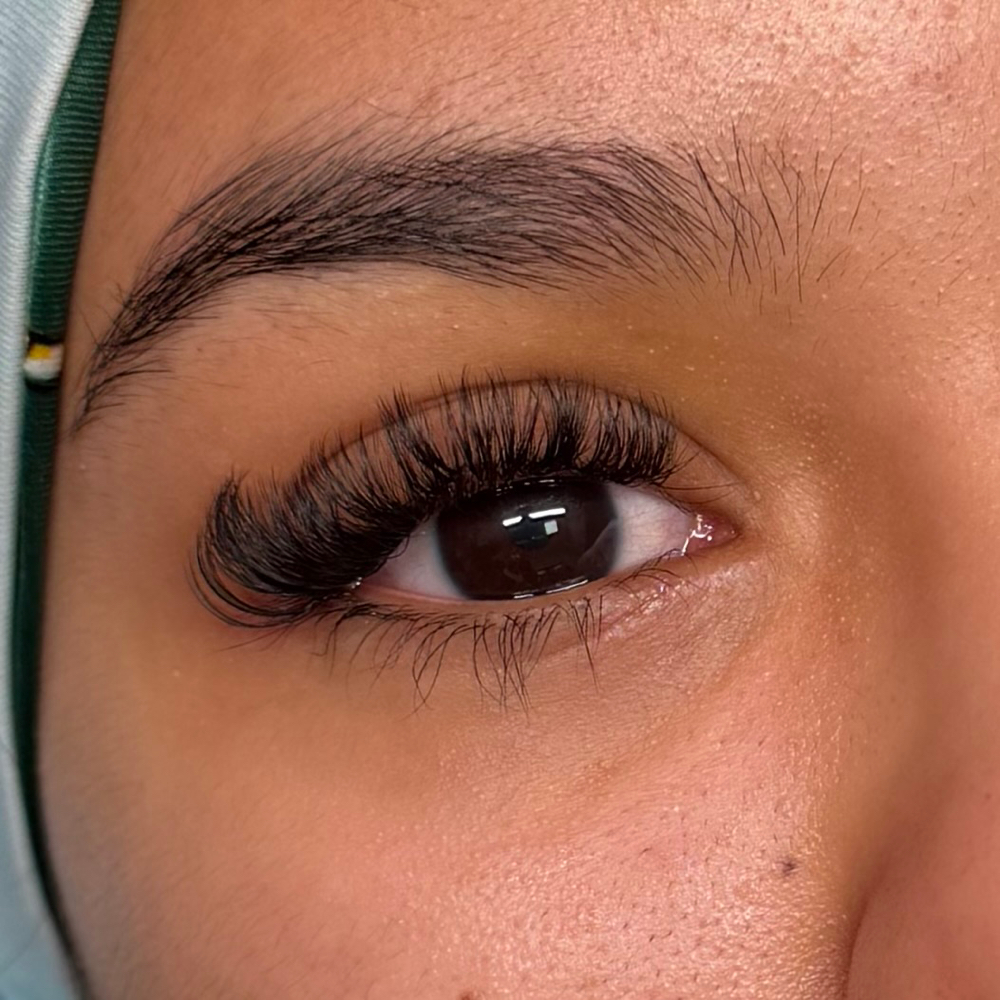 Volume Refill (2 - 2.5 Weeks)