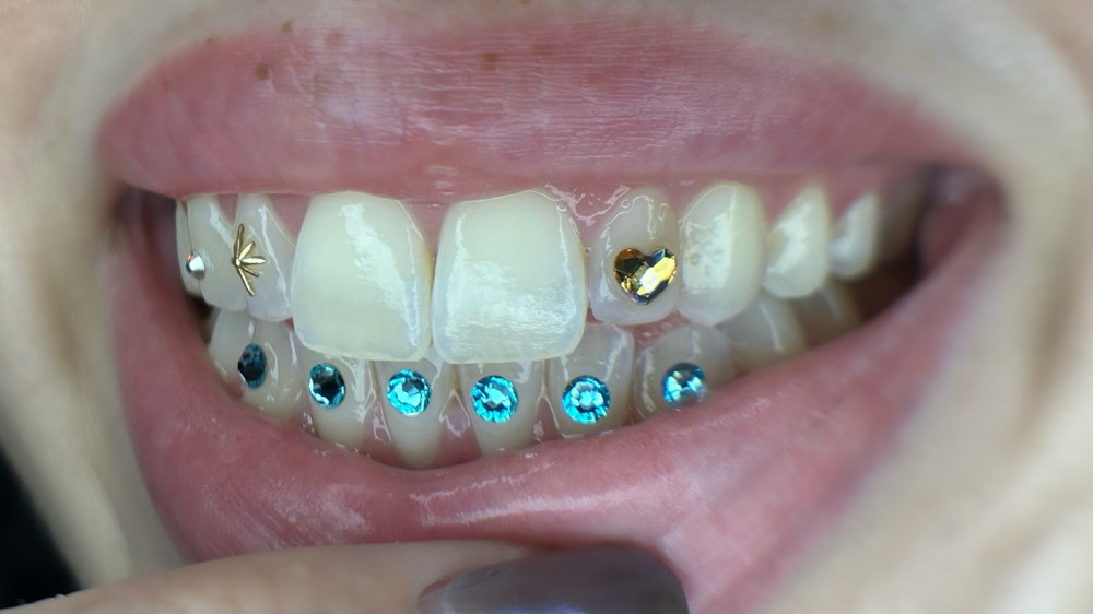 5-10 Crystal Freestyle Set