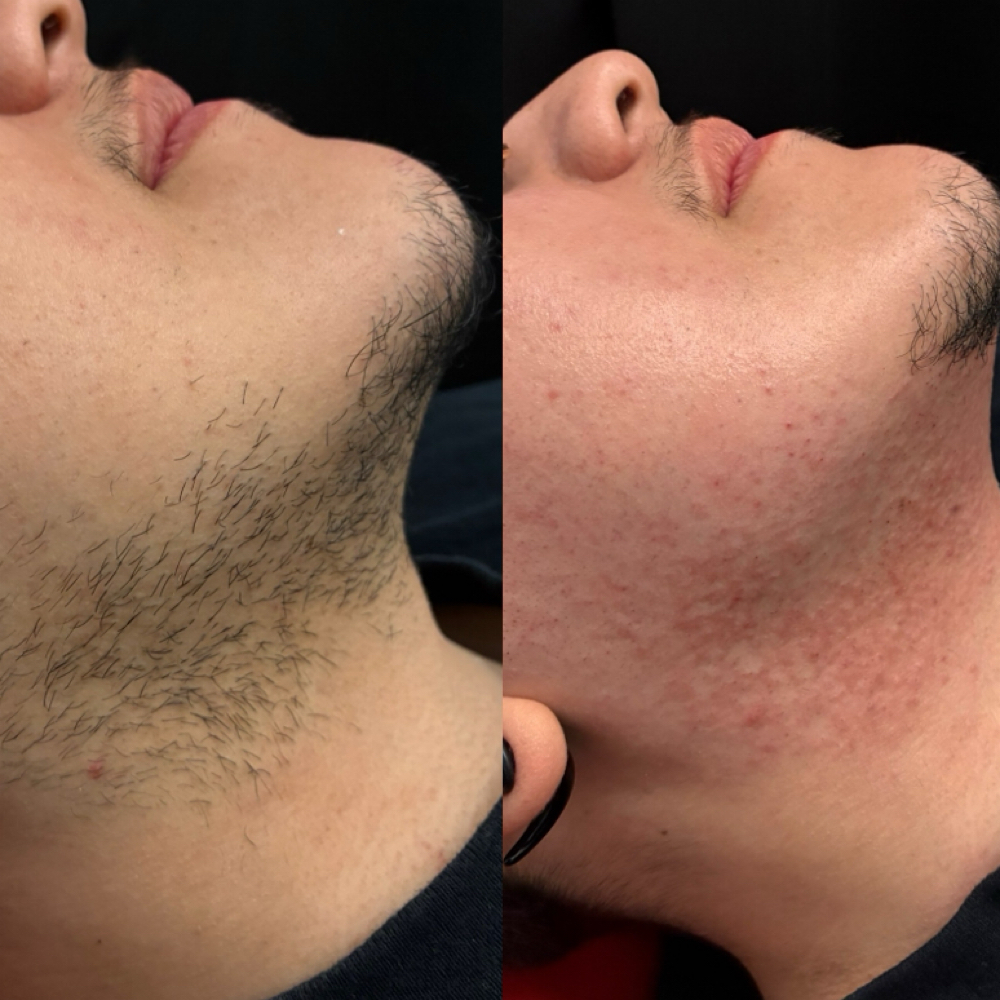 Jawline Wax at De Colores Beauty Bar in Chicago, IL