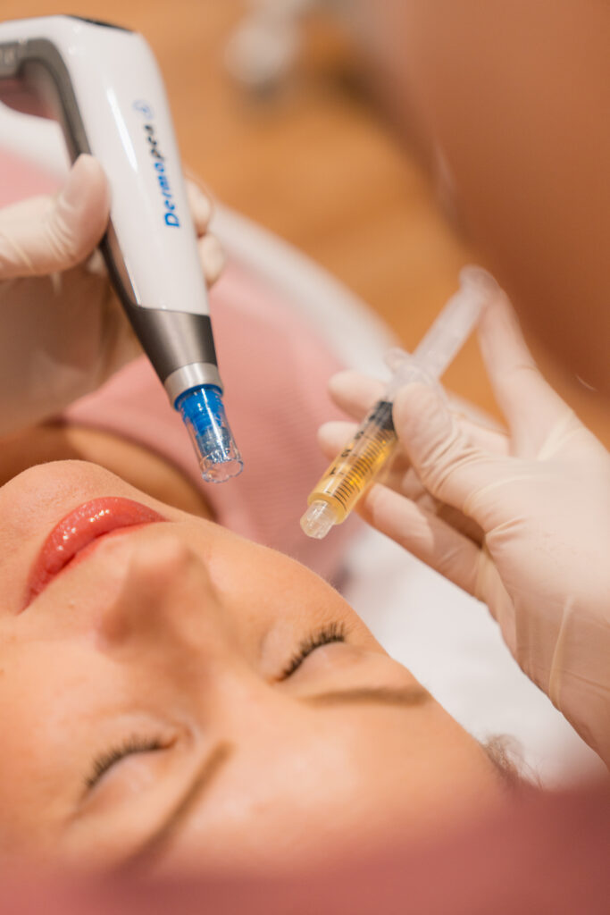 Plasma Facial
