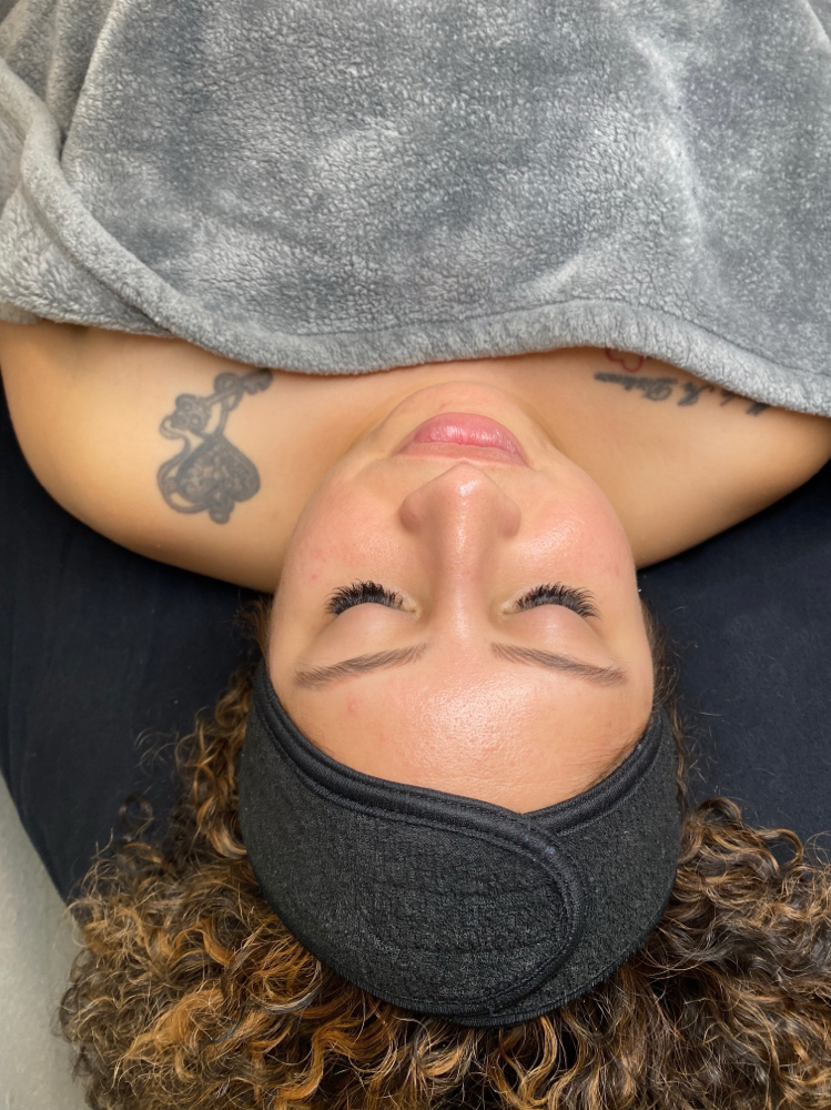 Acne Facial (w/ Peel)