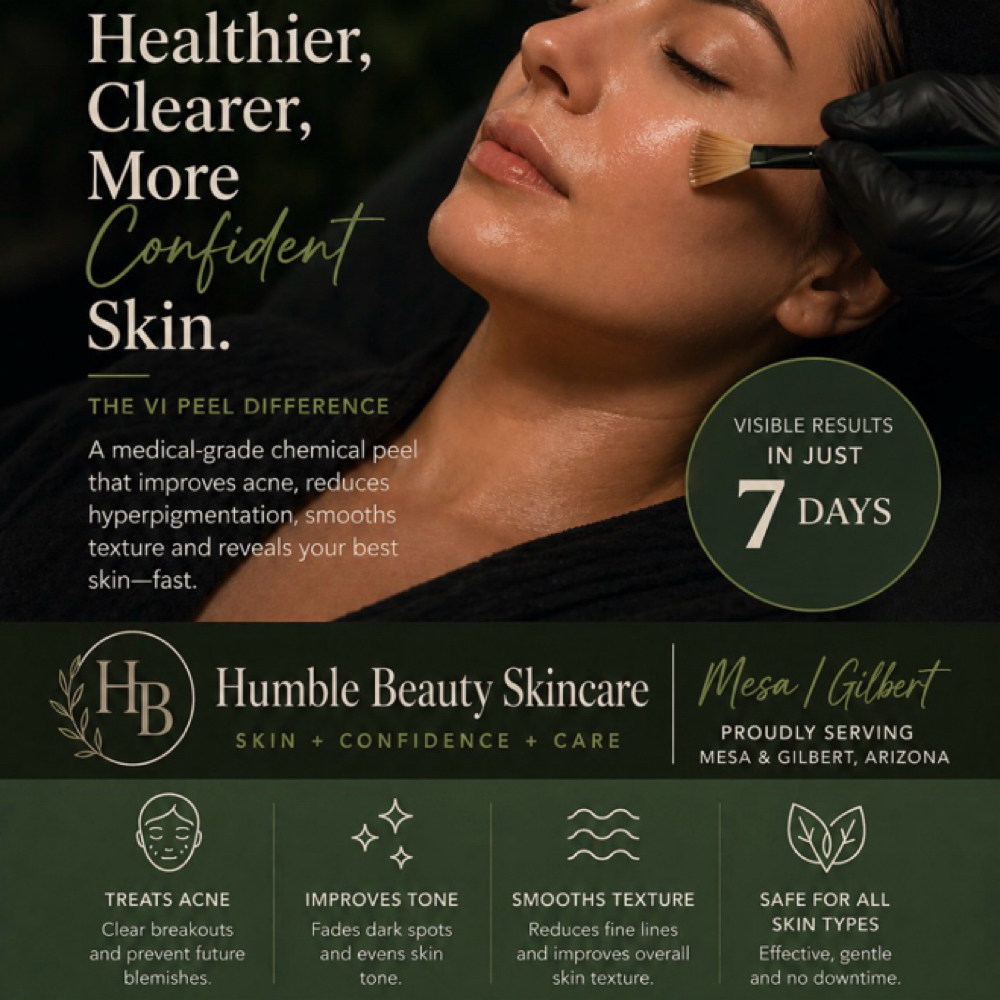 VI Peel Purity Acne Peel at Humble Beauty Skincare By Rachel Ventura in Mesa, AZ