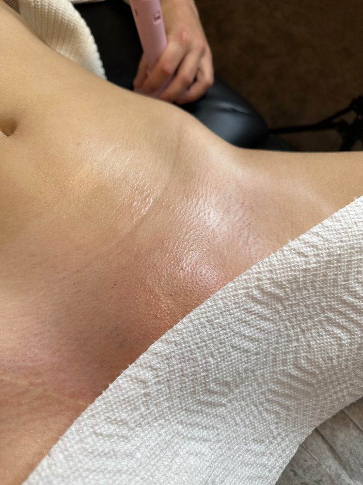 Brazilian Wax