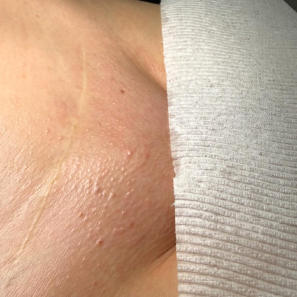 New Client Brazilian at WaxdByArianaMichelle in Latham, NY