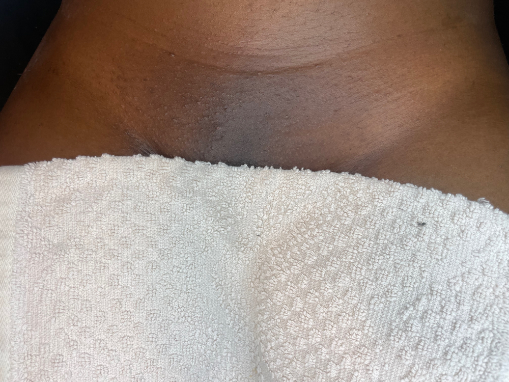 New Client Brazillian Wax