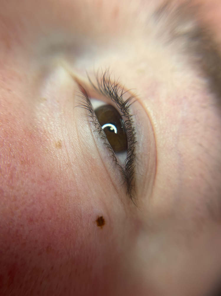 Beauty mark