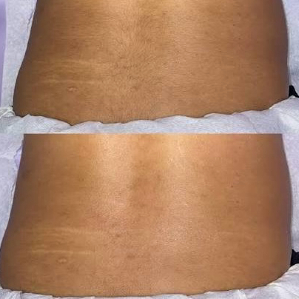 Lower Back at Belladz Wax Studio in Beltsville, MD