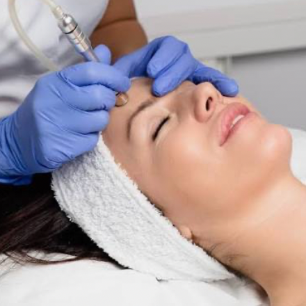 Dermaplanning at AK esthetics in Houston, TX