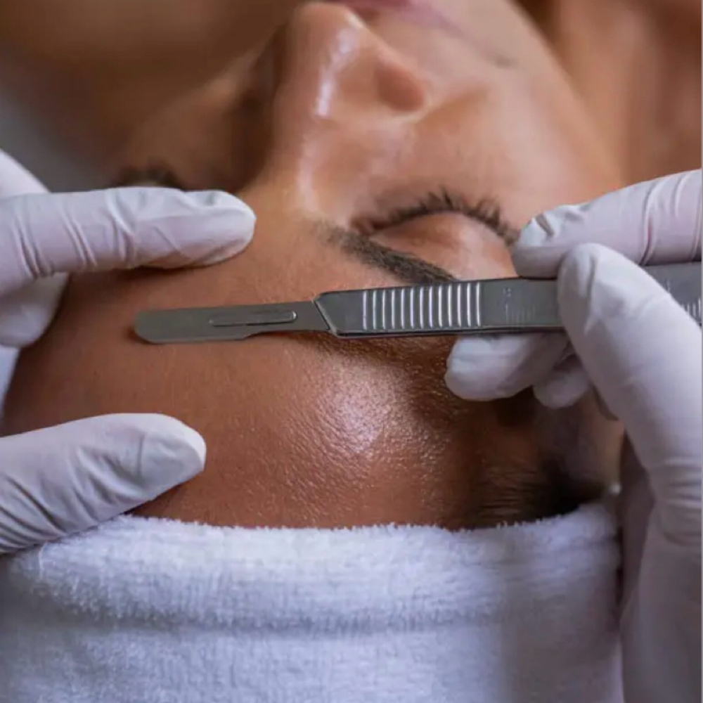 Dermaplane Facial at Desire Esthetics in Lodi, CA
