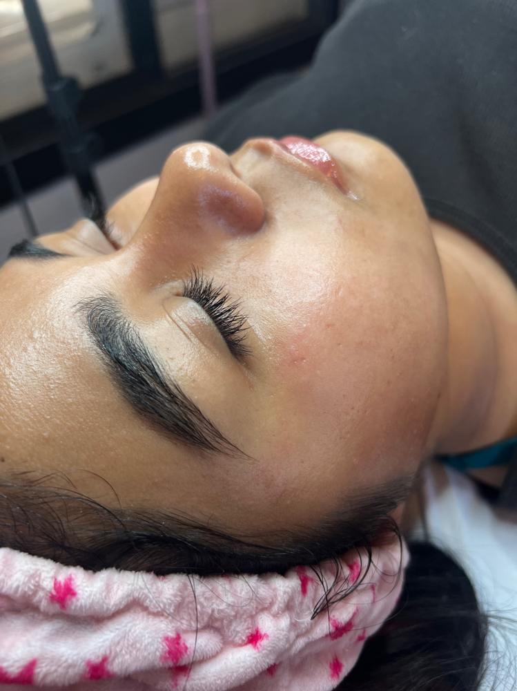 Dermaplane Facial