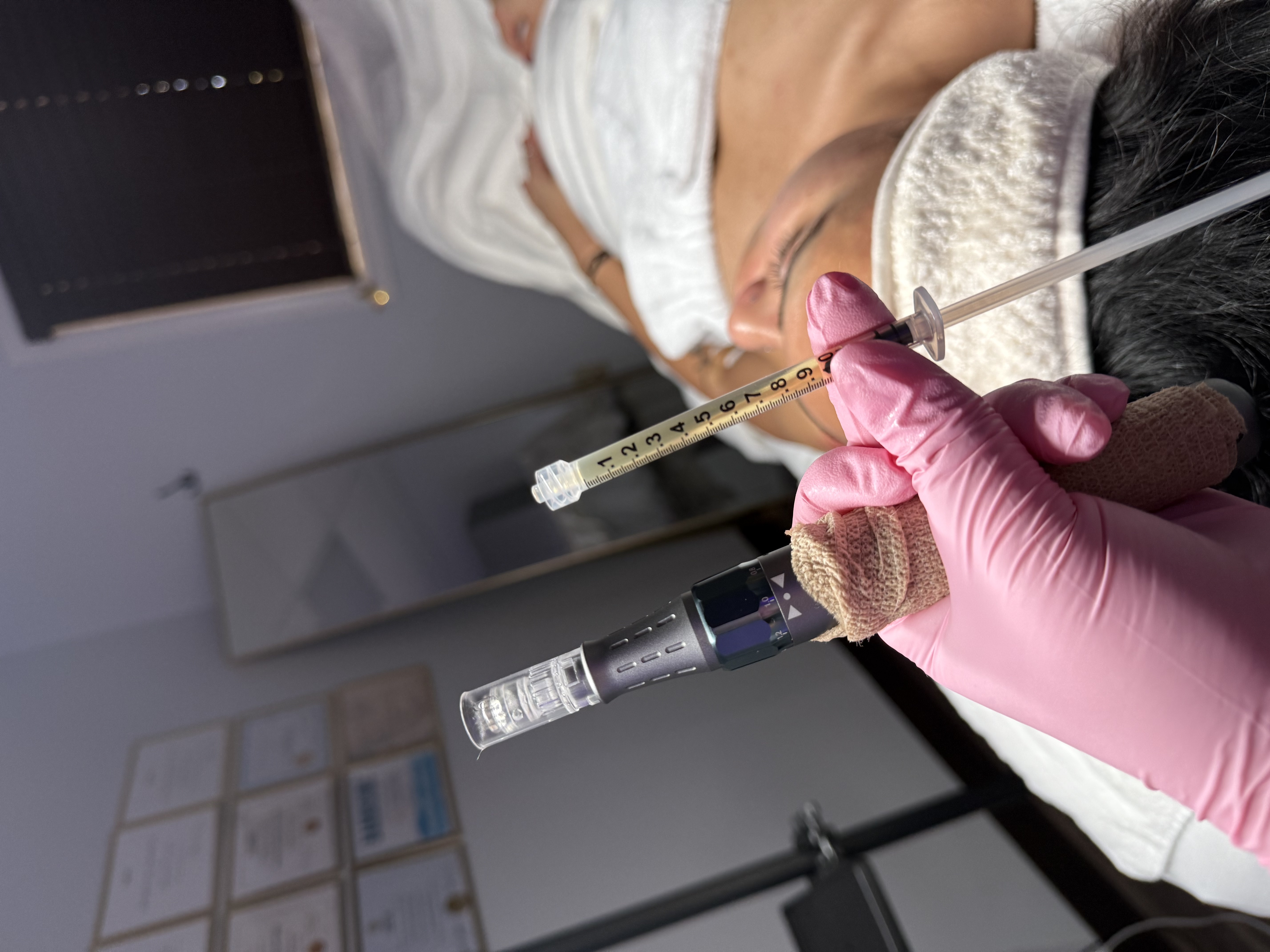 Microneedling with PRP