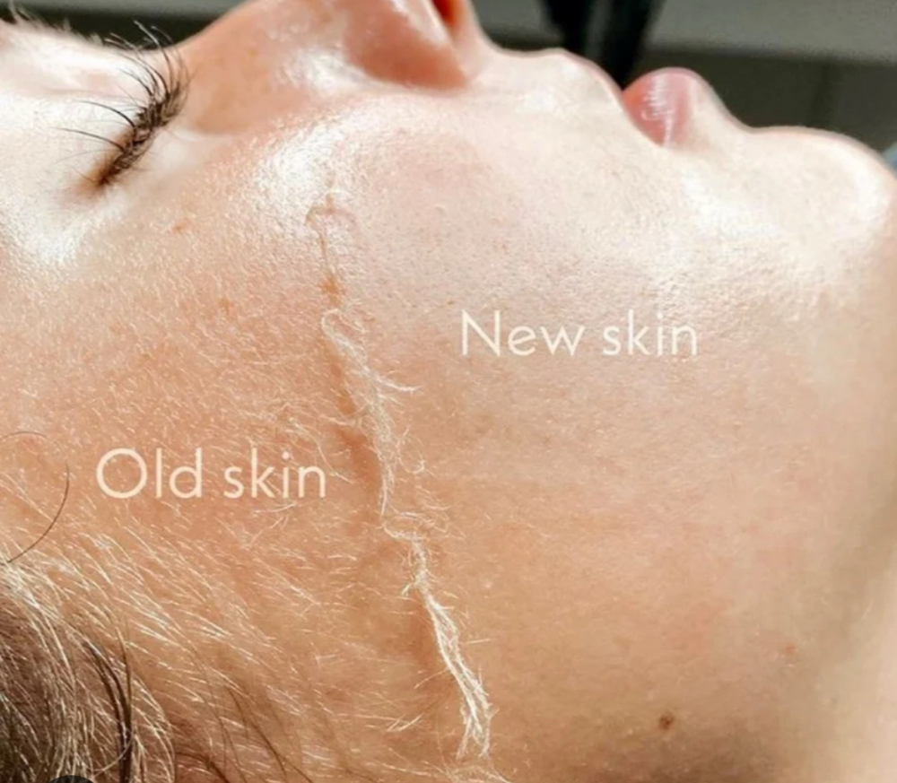 Dermaplaning Facial at NAIKED ESTHETICS BY NAOMI in TUCSON, AZ