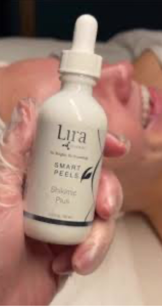 Facial Smart Peel (Lira) Add On