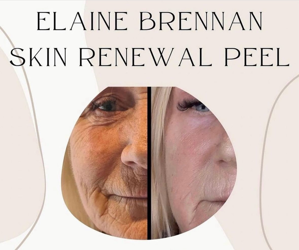 Elaine Brennan Skin Renewal