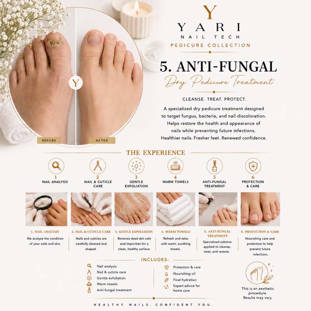 Fungal Nail Care Dry Pedi at Yari Nail Tech in Covina, CA