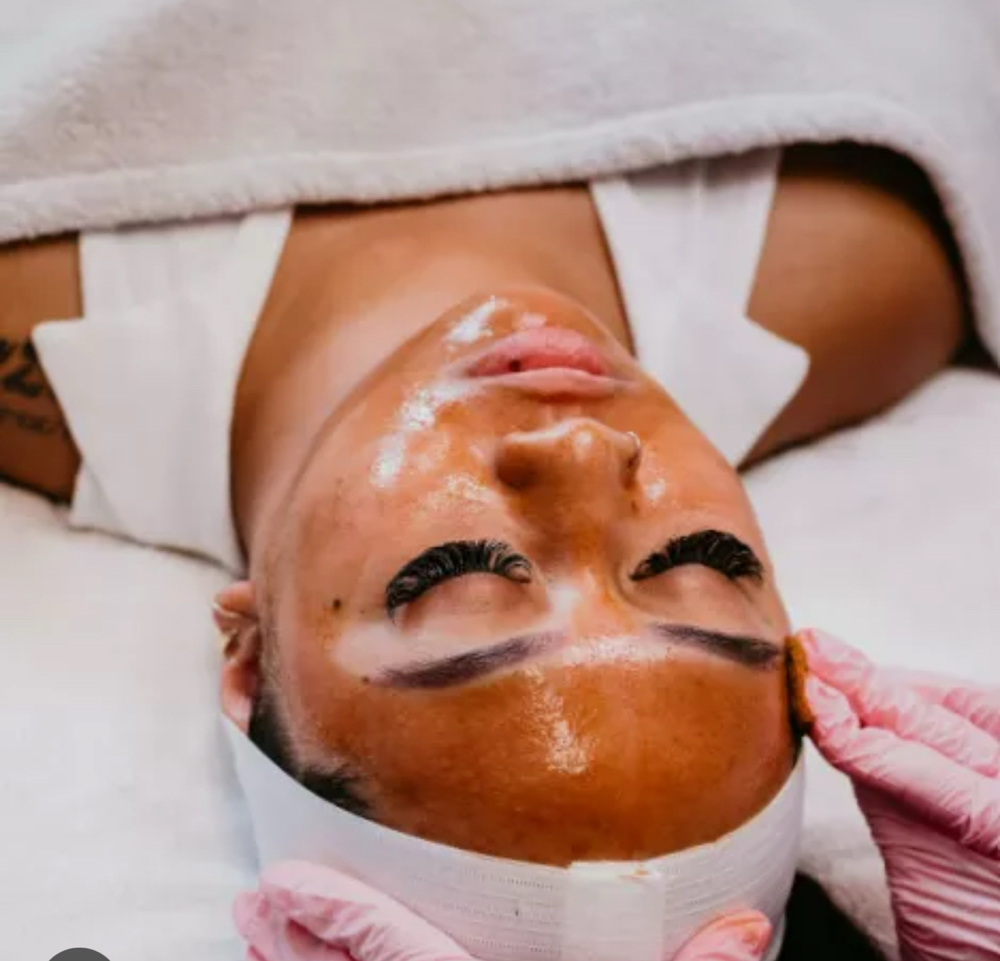 Chemical Peel at B’Luxury Beauty & Body Studios in Doraville, GA