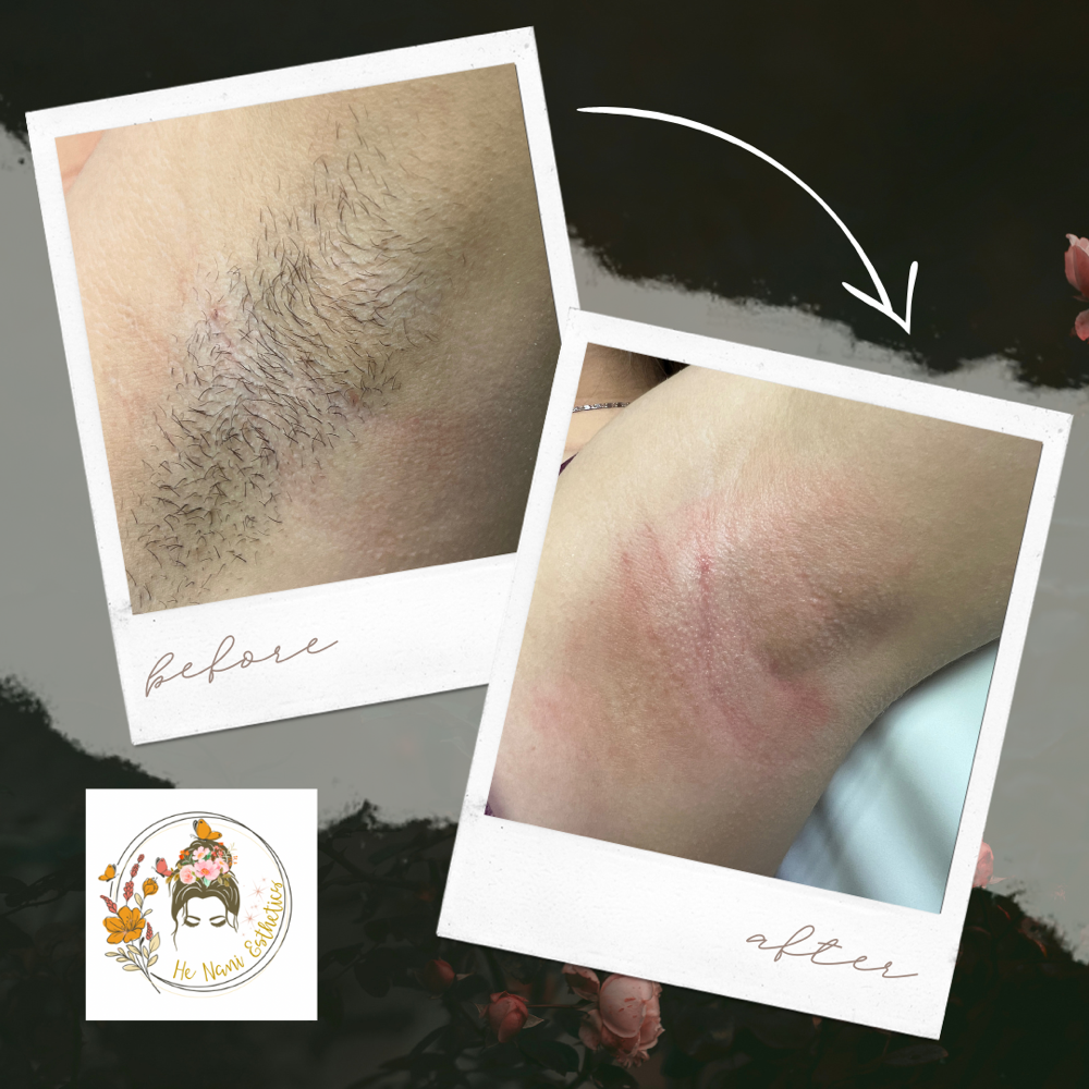 Underarm Wax