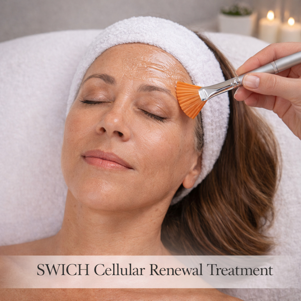 SWiCH Cellular Renewal Treatment at Auralie Aesthetics in Bradenton, FL