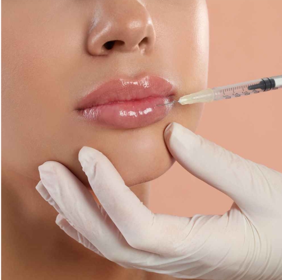 Dermal Filler
