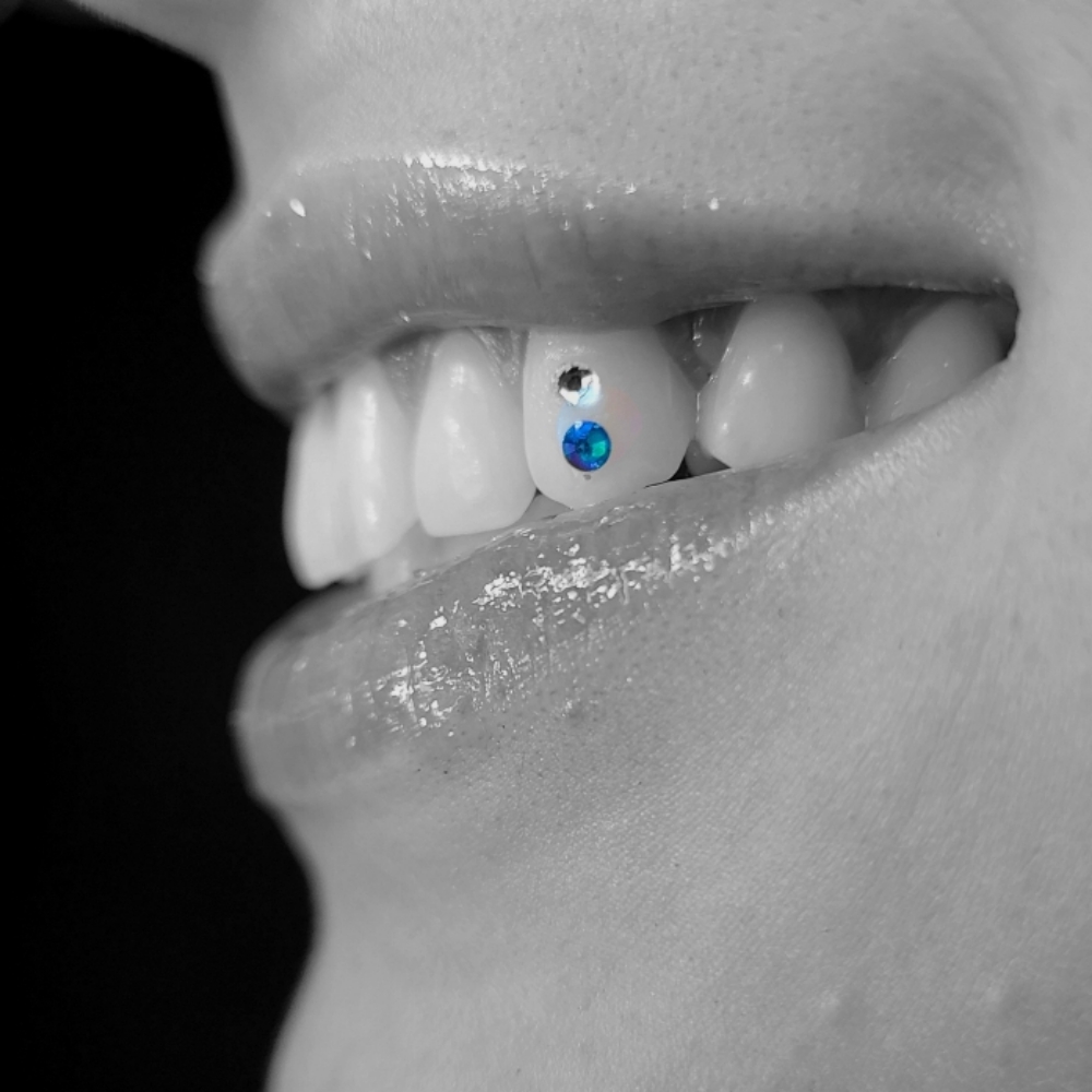 Tooth Gem: 2 Swarovski Gems at The Neon Door in Tucson, AZ