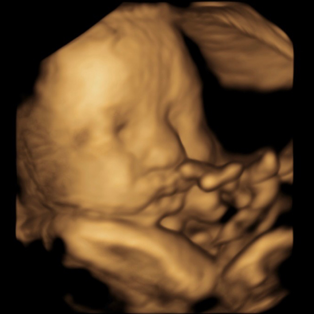💕The Bump Experience (13+ Weeks) at Bump Studio  LLC in Rome, GA