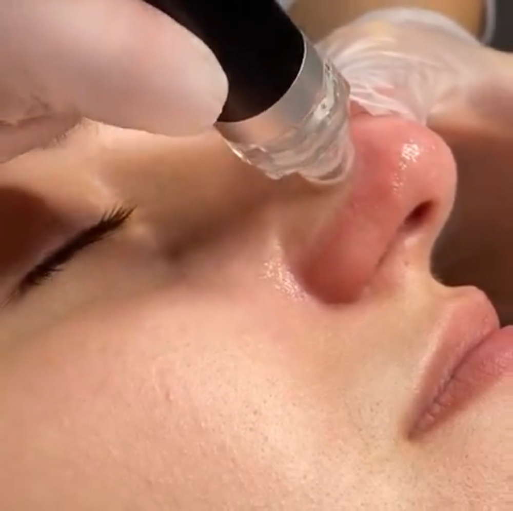 Hydro Facial Prime