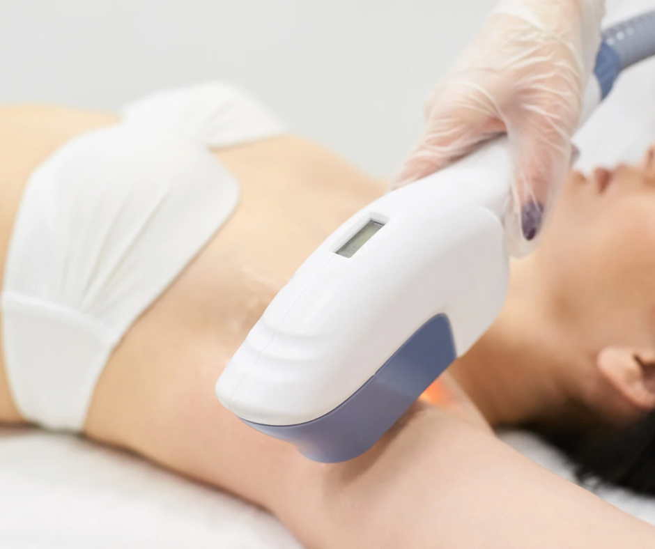 Super hair Removal Single Sessions