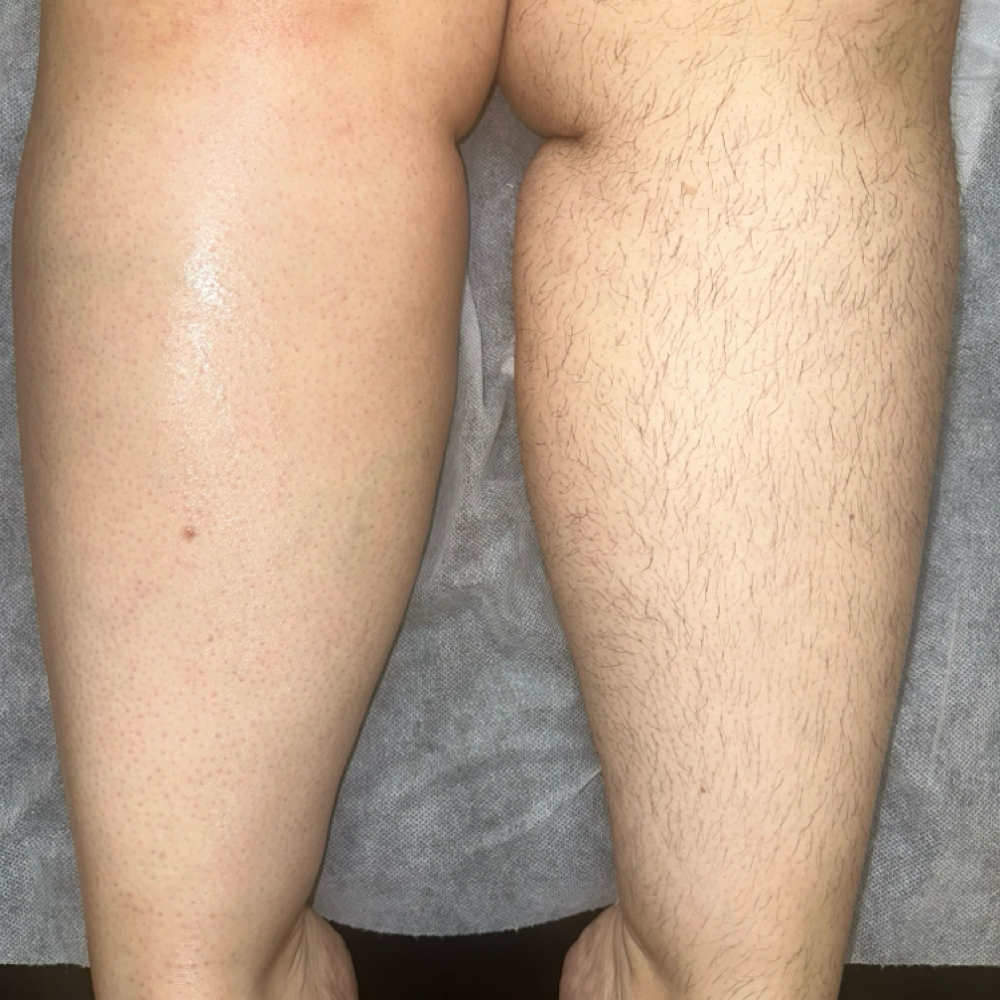 Half Legs at The Landing Strip Wax Studio LLC in Championsgate, FL