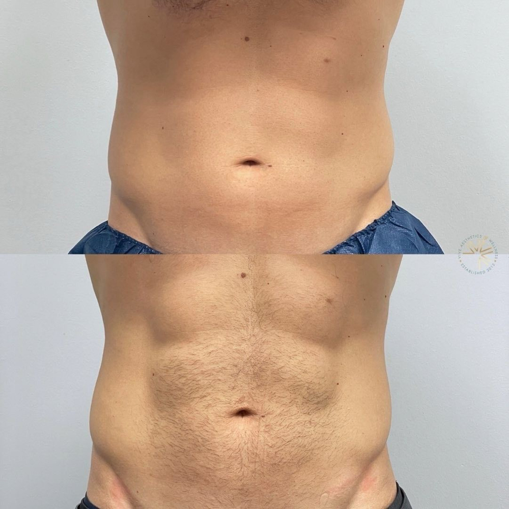 Stomach