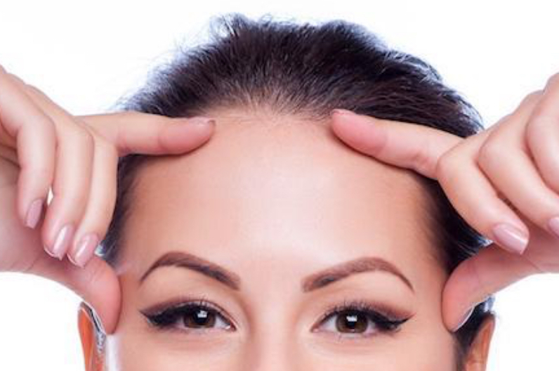 Glabella(11’s) Forehead & Crows T1