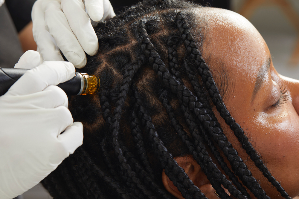 Hydrafacial Scalp(Keravive)