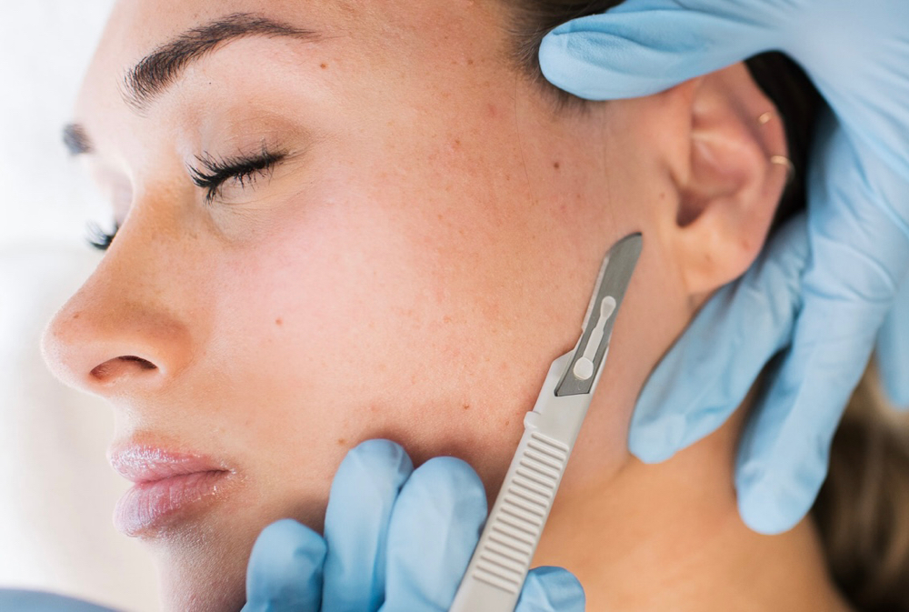 Dermaplane Facial