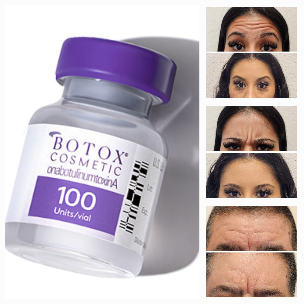 Botox