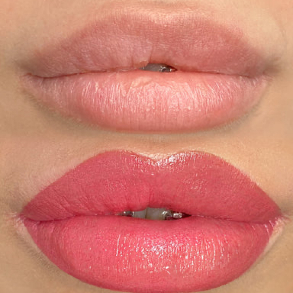 Labios at RossyEstetic in Metaire, LA