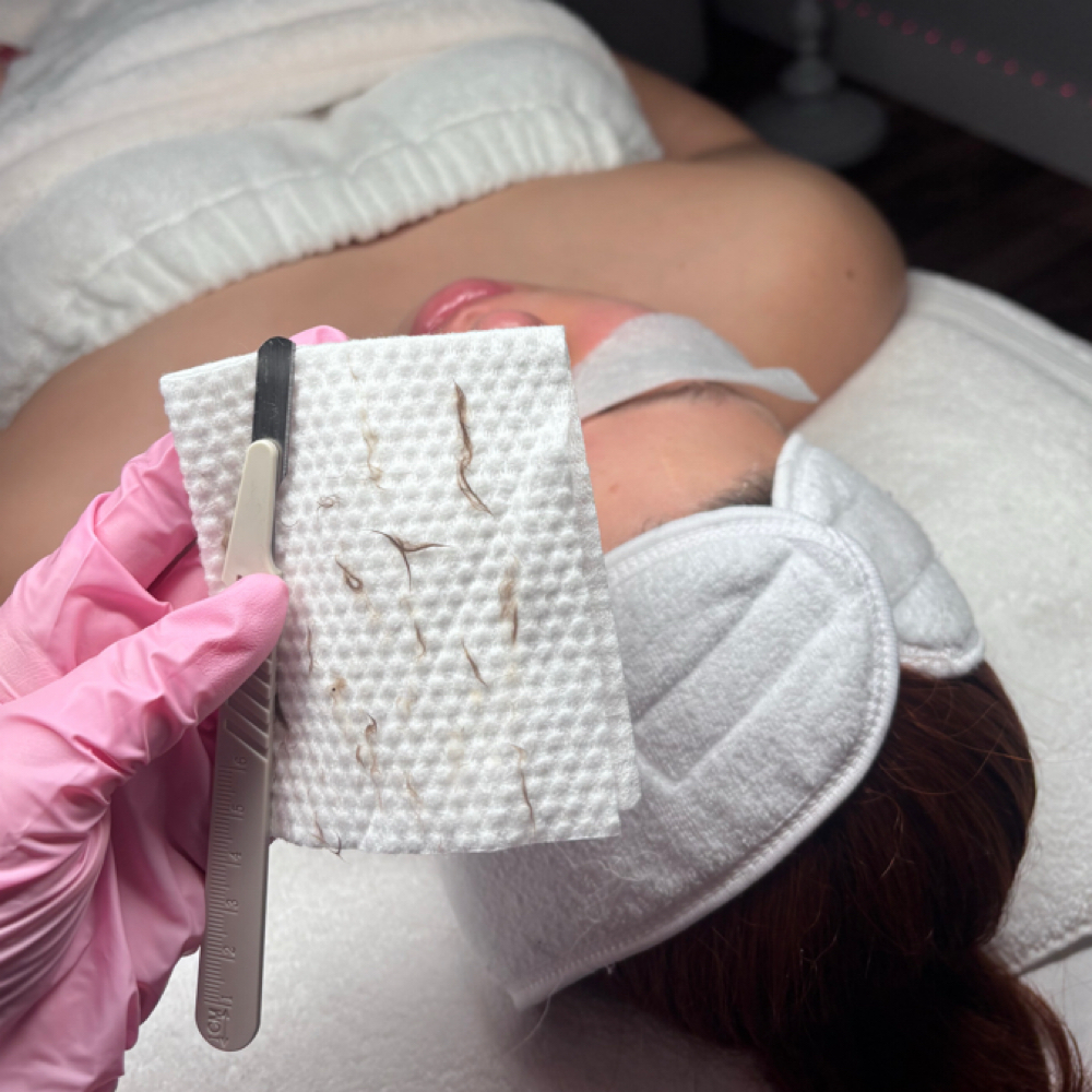 Deep Facial + Dermaplaning at Adri_beautyskincare in Miami Lakes, FL