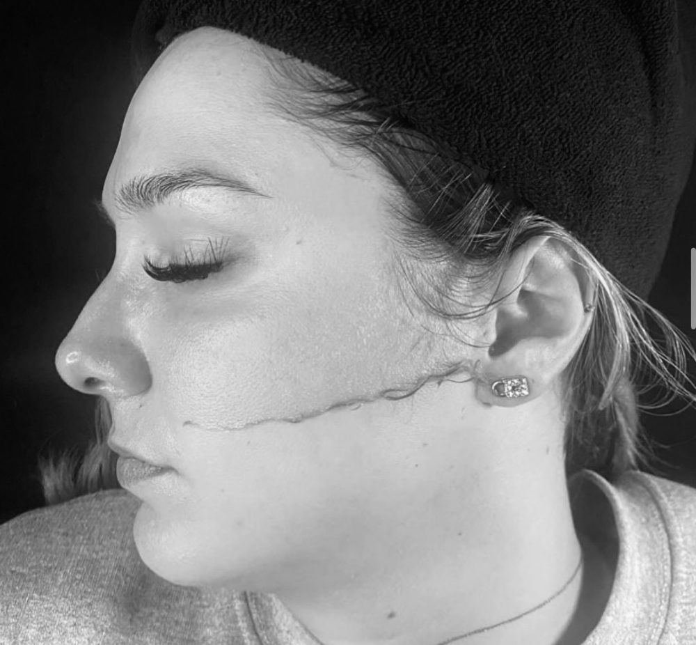 Dermaplane Treatment ONLY