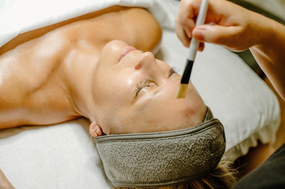 Chemical Peel (monthly or Add-on).